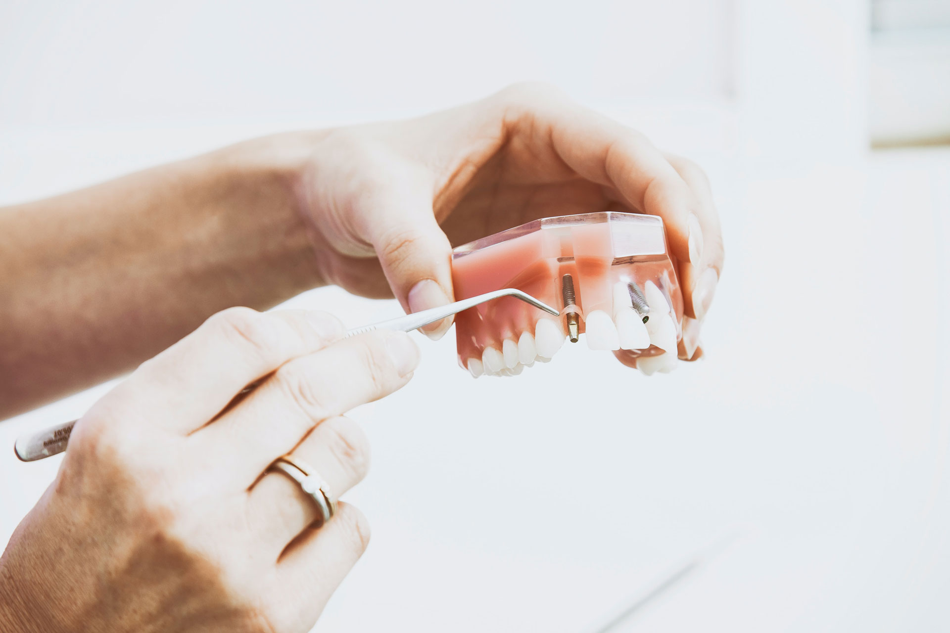 Hand hält Zahnprothese