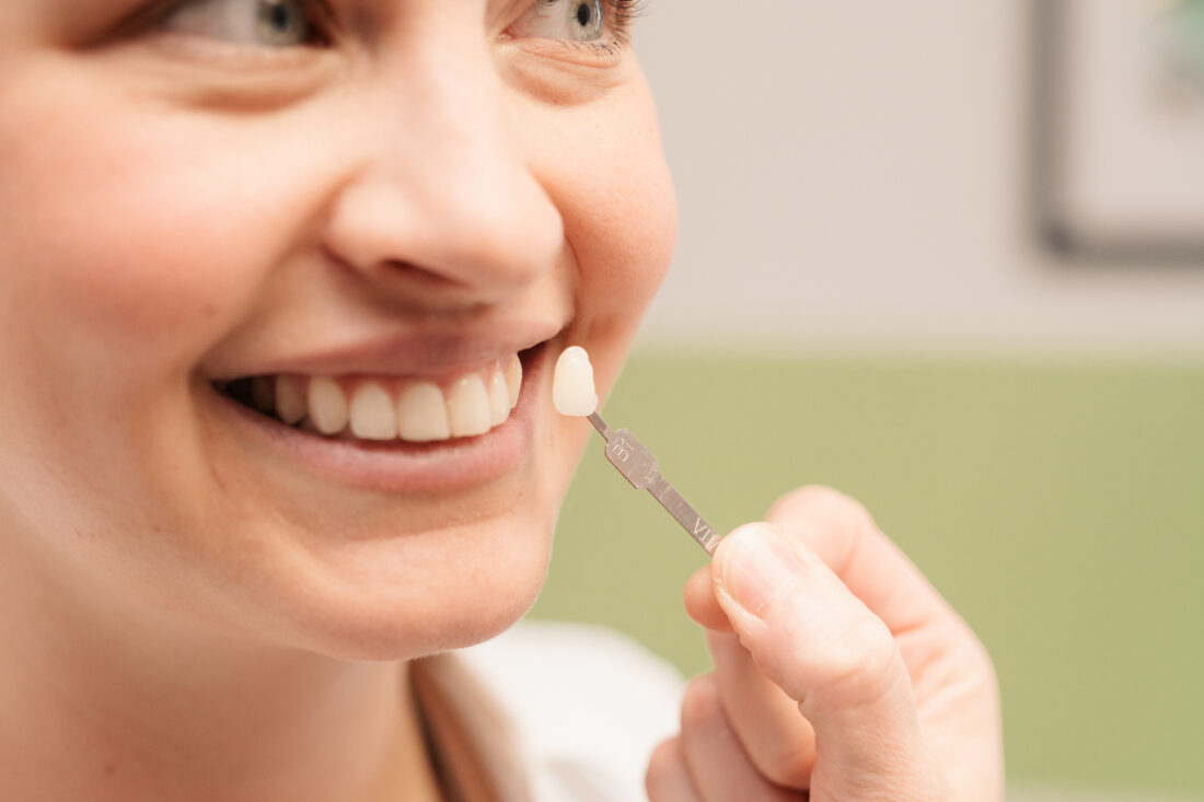 Passgenaue Veneers werden von Zahnärztin überprüft